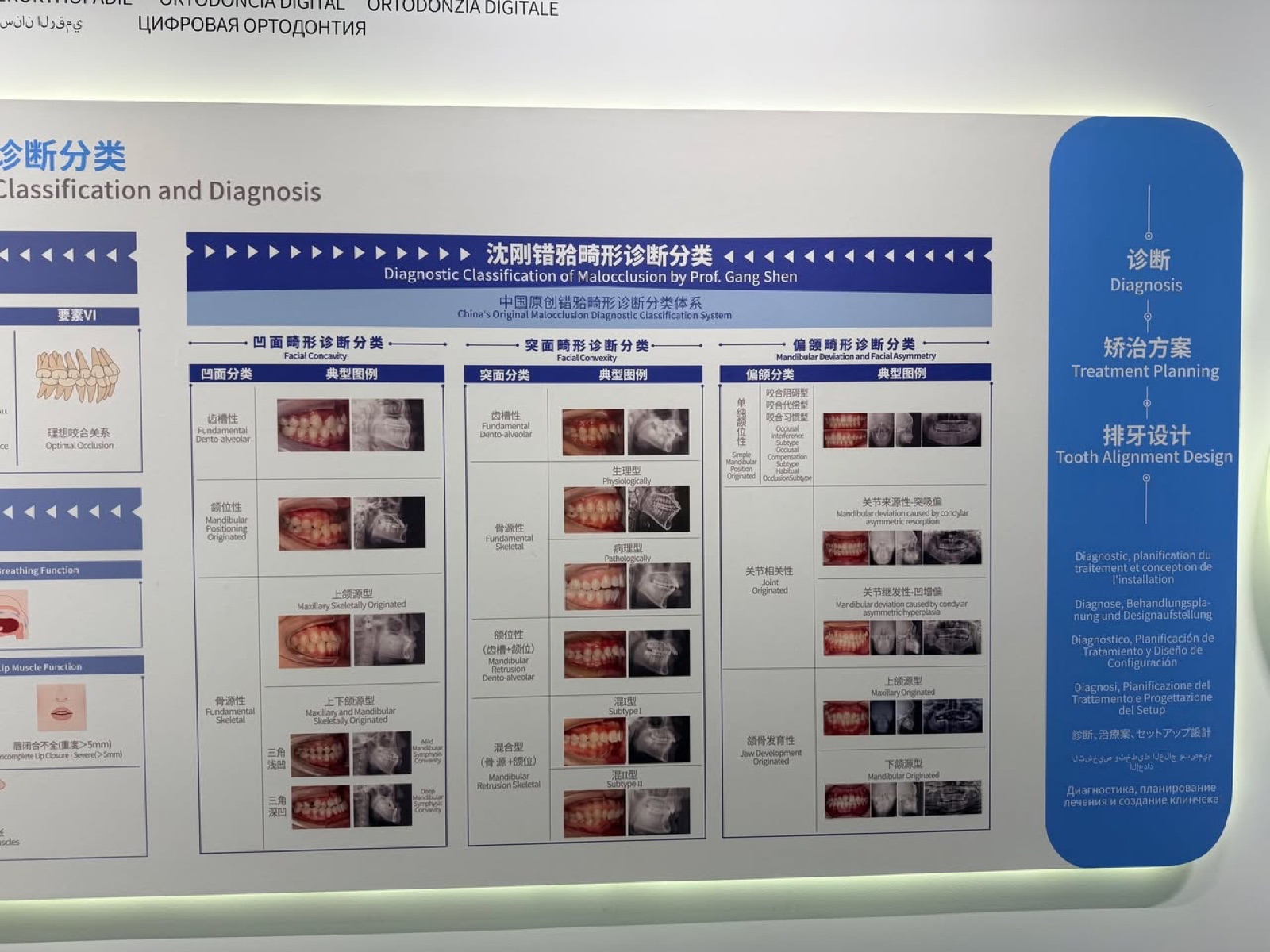 沈剛教授錯𬌗畸形診斷分類展板